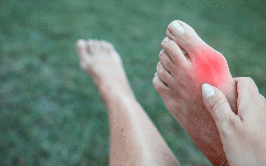 Bunion Removal Options