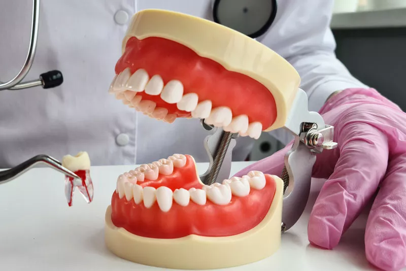 What to Expect After Getting Dental Implants