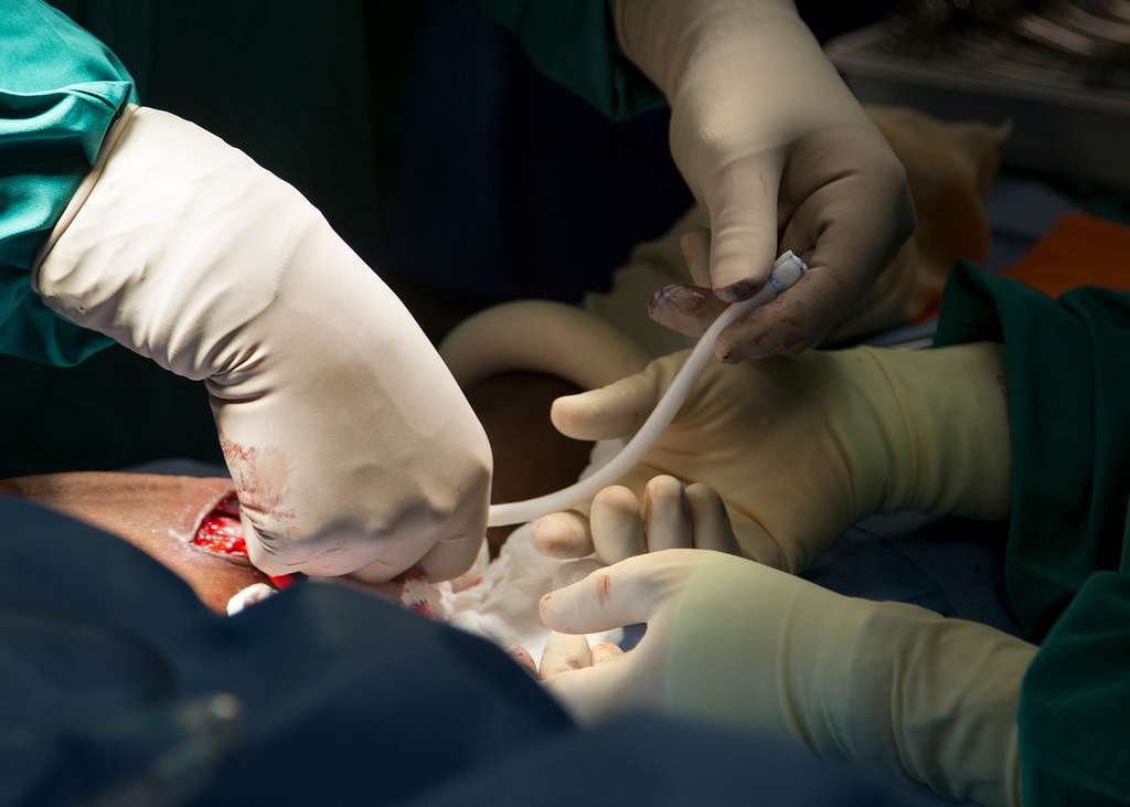 Preparing for Dialysis Access Surgery