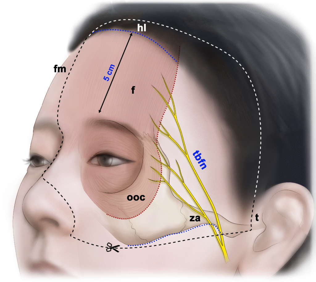 An In-depth Look Into the Mechanism of Botox