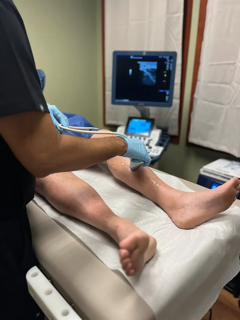 Evaluating Treatment Options for Chronic Venous Insufficiency