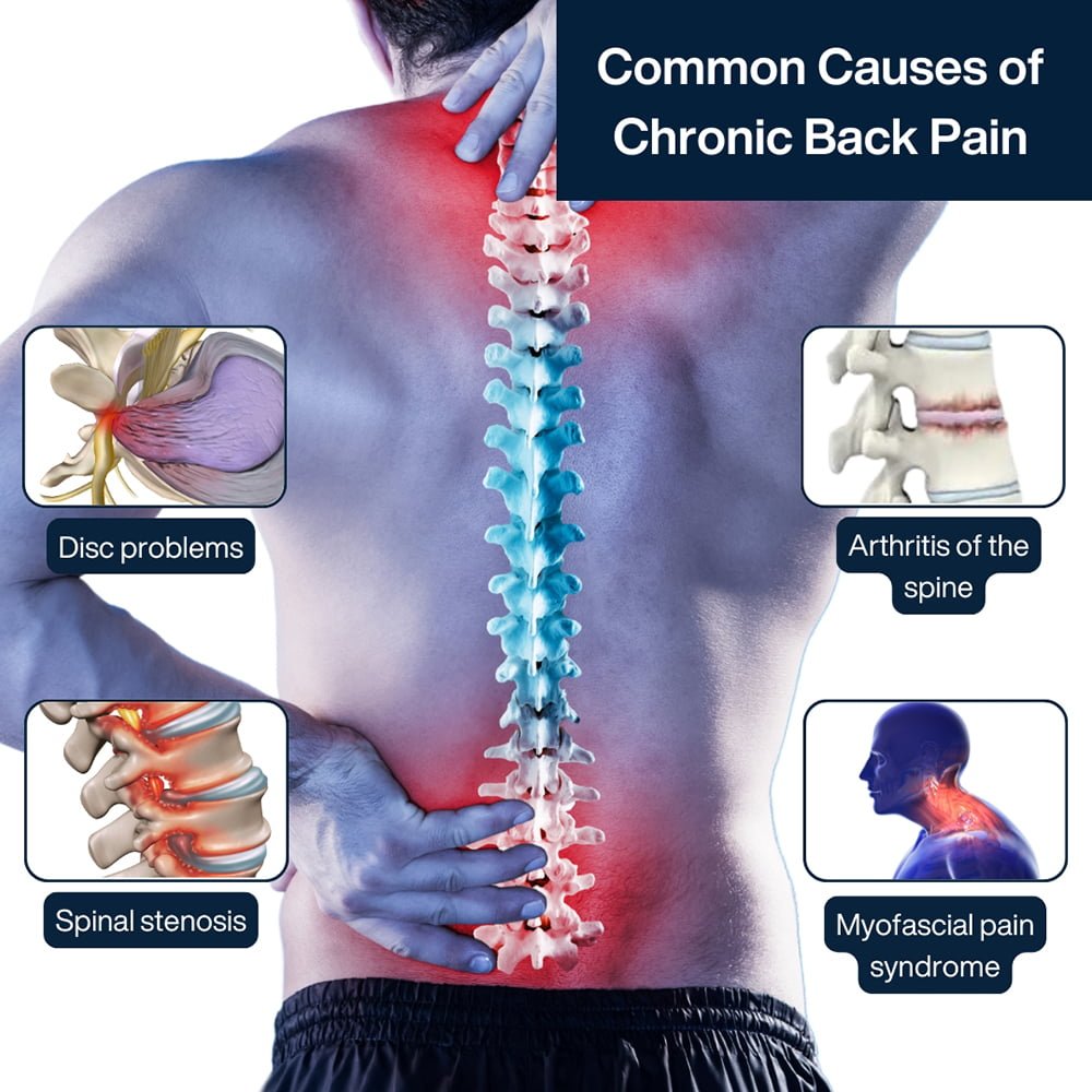 How To Manage Chronic Back Injuries