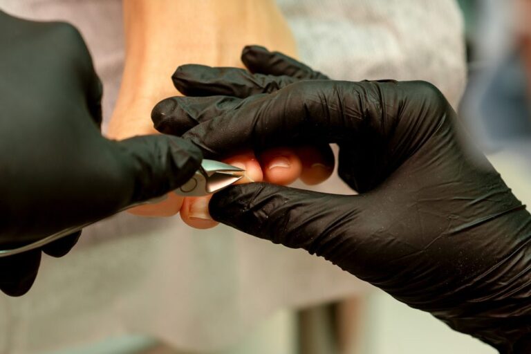When to Consult a Podiatrist for Nail Issues