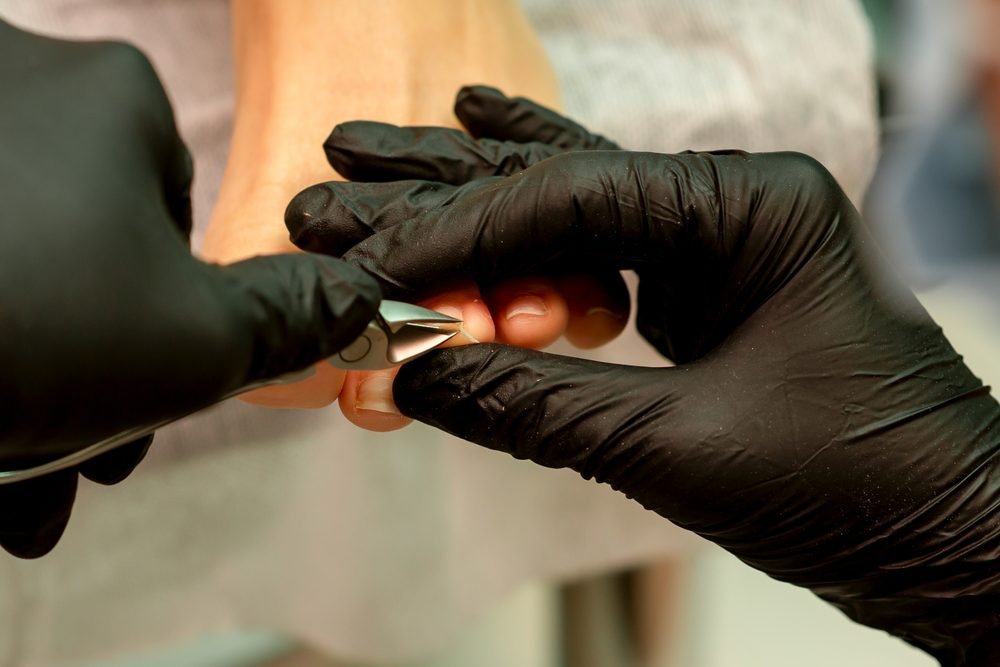 When to Consult a Podiatrist for Nail Issues