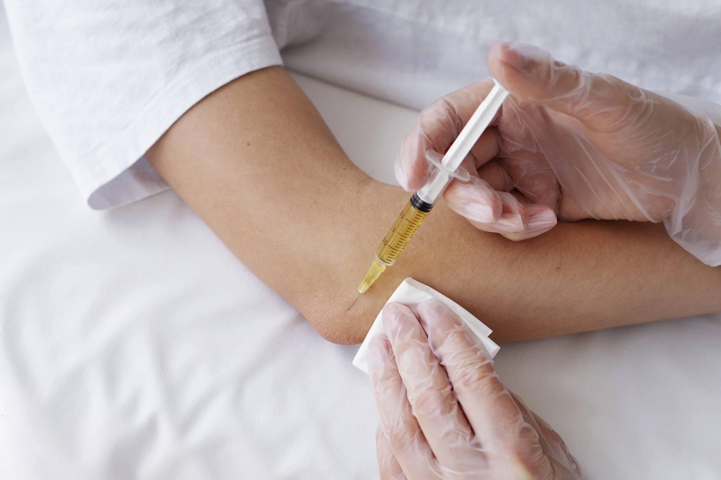 Benefits of PRP Therapy for Sports Injuries