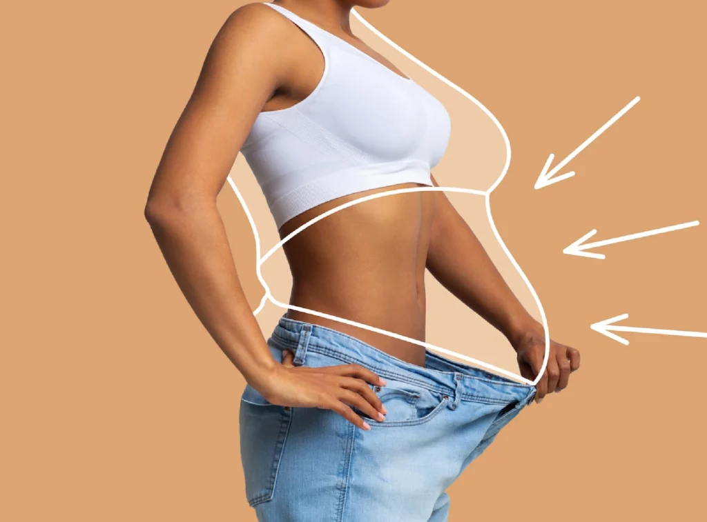 Benefits of Weight Loss Surgery