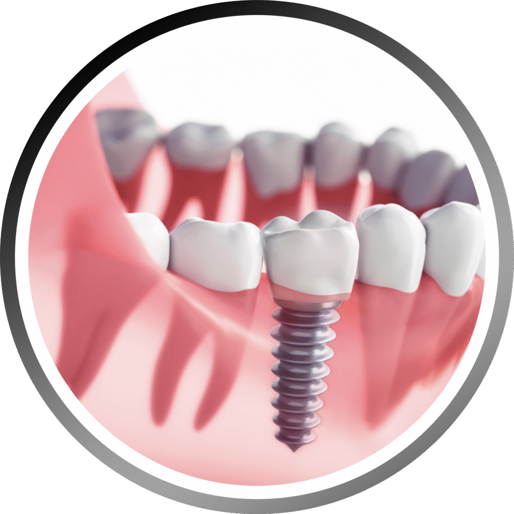 How Dental Implants Can Improve Your Quality of Life